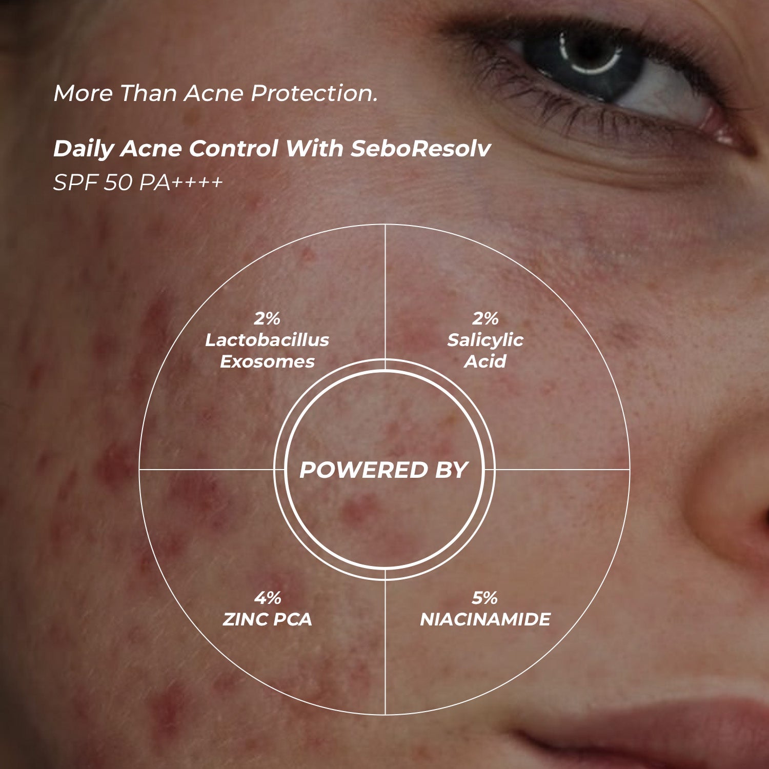 Eclipse Solaire SeboResolv Acne Clarifying SPF 50 PA++++ (UVA, UVB, IR & BR) | No white cast | Non-greasy | Oily/Acne prone skin 60ml
